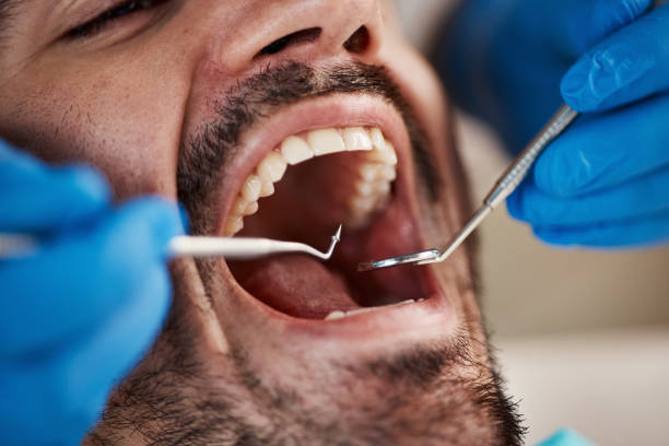 Best Teeth Whitening  in Cridersville, OH